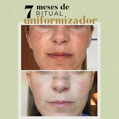 Combo 2x - Fórmula Uniformizadora (60 Dias)
