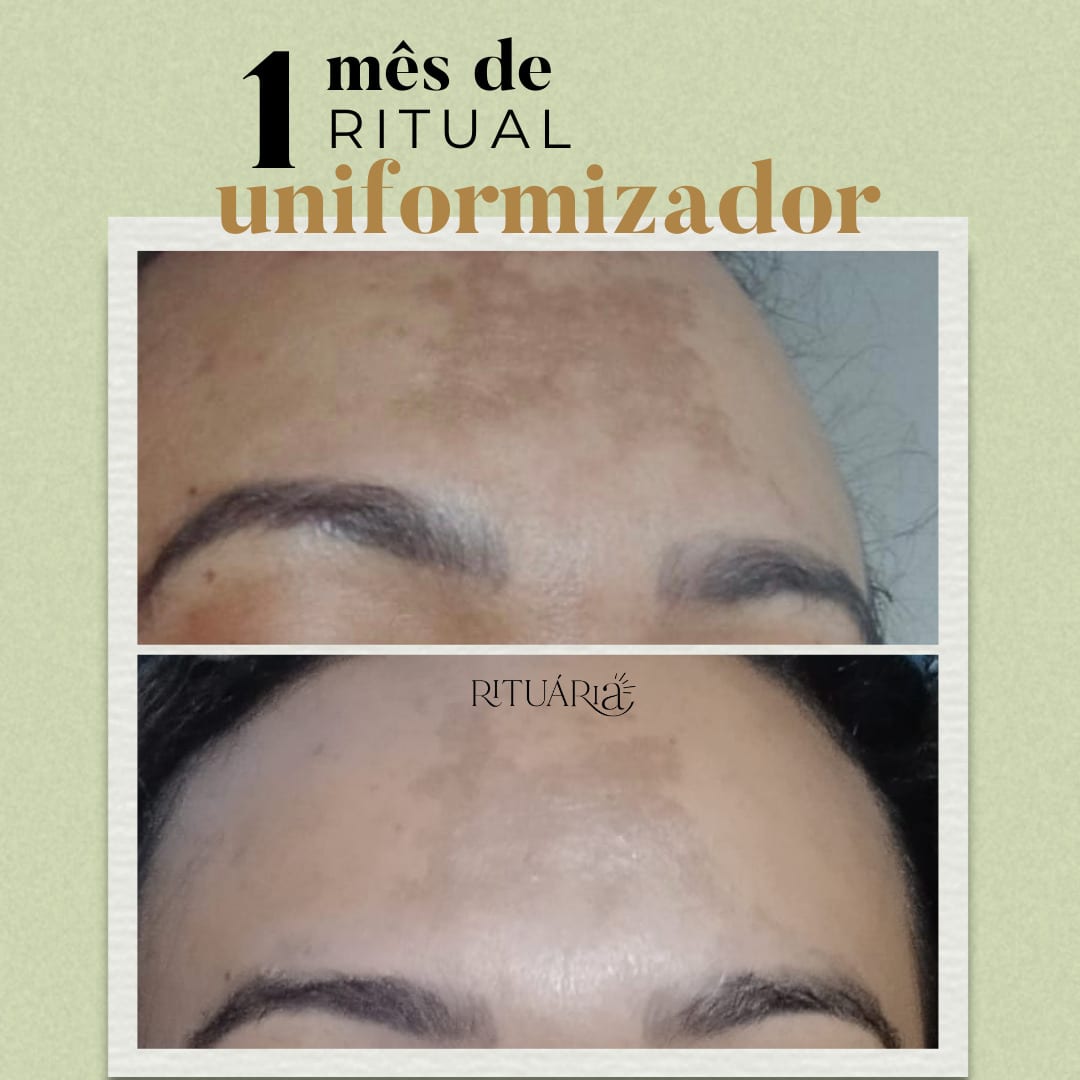 Combo 2x - Fórmula Uniformizadora (60 Dias)