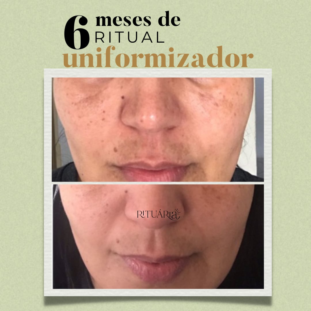 Combo 2x - Fórmula Uniformizadora (60 Dias)