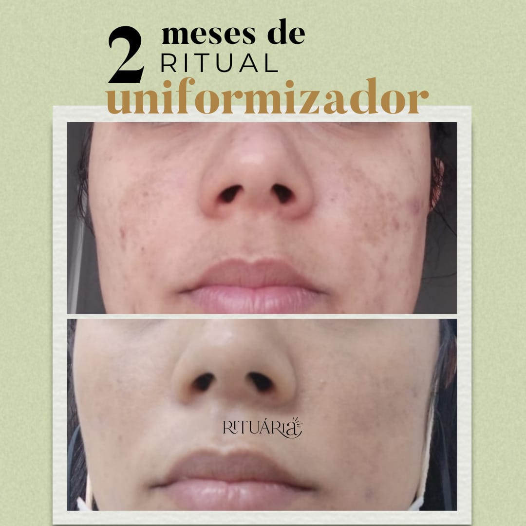 Combo 2x - Fórmula Uniformizadora (60 Dias)