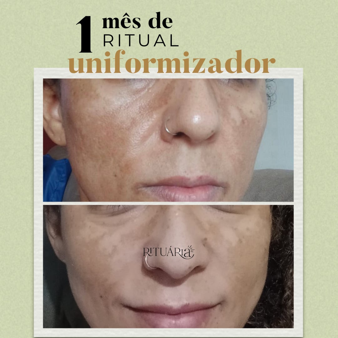 Combo 3x - Fórmula Uniformizadora (90 Dias)