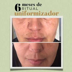 Combo 3x - Fórmula Uniformizadora (90 Dias)