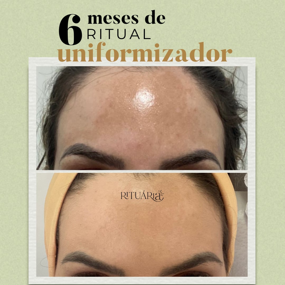 Combo 3x - Fórmula Uniformizadora (90 Dias)