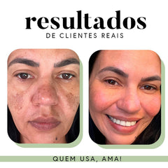 Fórmula Antioxi Nutri - 30 Cápsulas
