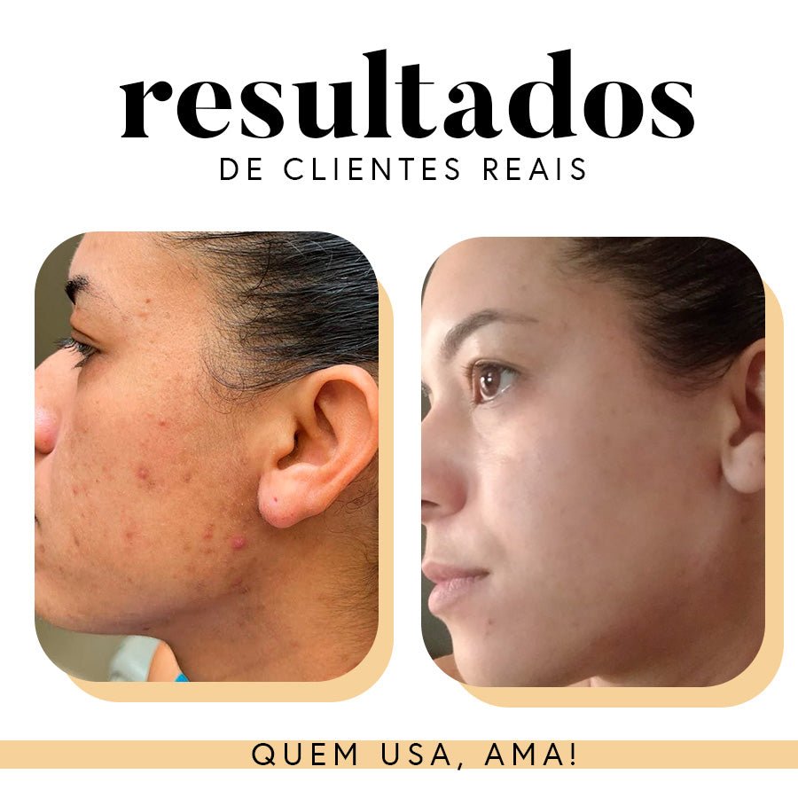 Fórmula Antioxi Nutri - 90 Cápsulas