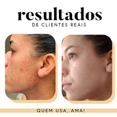 Fórmula Antioxi Nutri - 90 Cápsulas