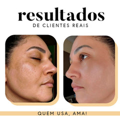 Fórmula Antioxi Nutri - 90 Cápsulas