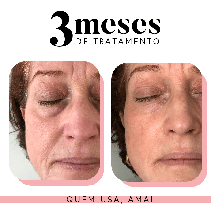 Kit Ritual Essencial Fabuloso Anti-Idade