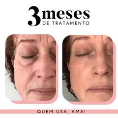 Kit Ritual Essencial Fabuloso Anti-Idade
