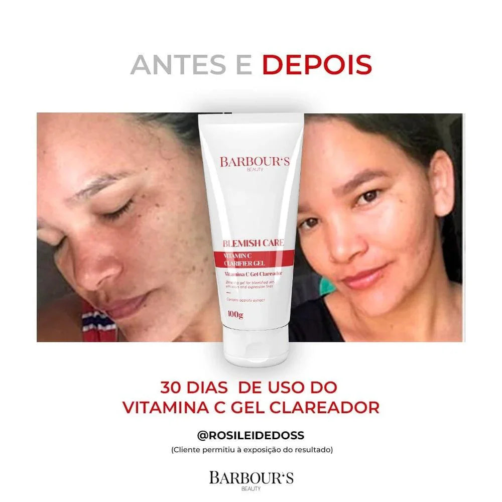 Kit Rotina Clareadora Intensiva (6 Produtos - Tratamento Rende 3 Meses)