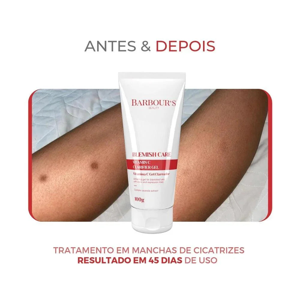 Kit Rotina Clareadora Intensiva (6 Produtos - Tratamento Rende 3 Meses)