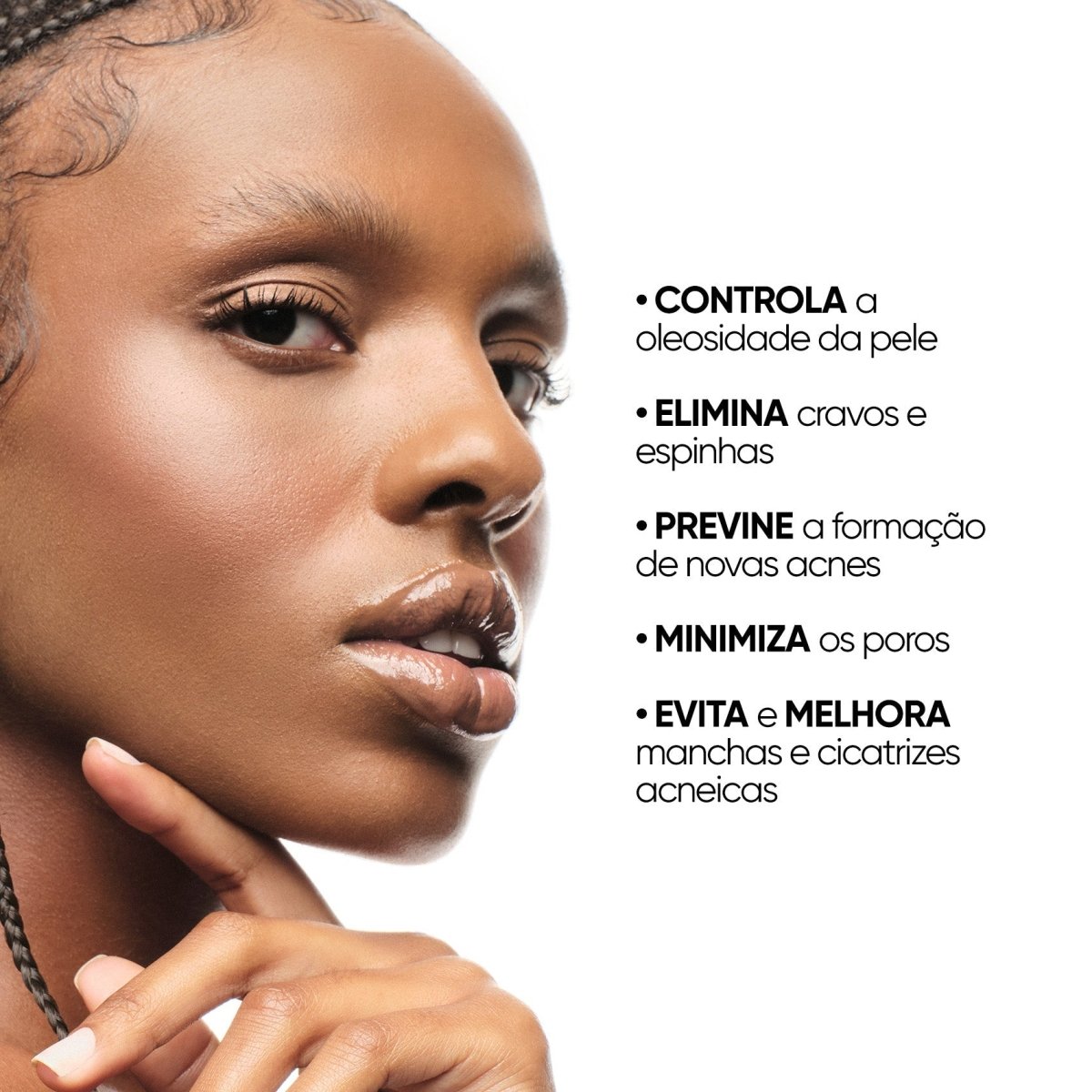 Sérum facial antiacne e oleosidade 10% ácido glicólico + 0,5% ácido salicílico