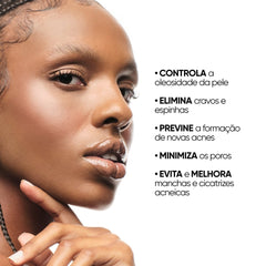Sérum Facial Antiacne e Oleosidade + Brinde Cleanser Oil Control